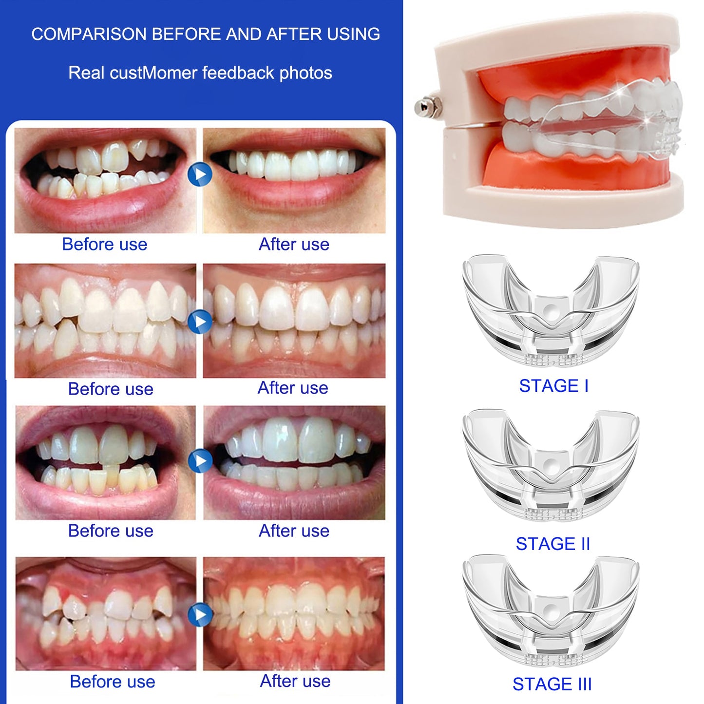 Orthodontic Braces Dental Braces Smile Teeth